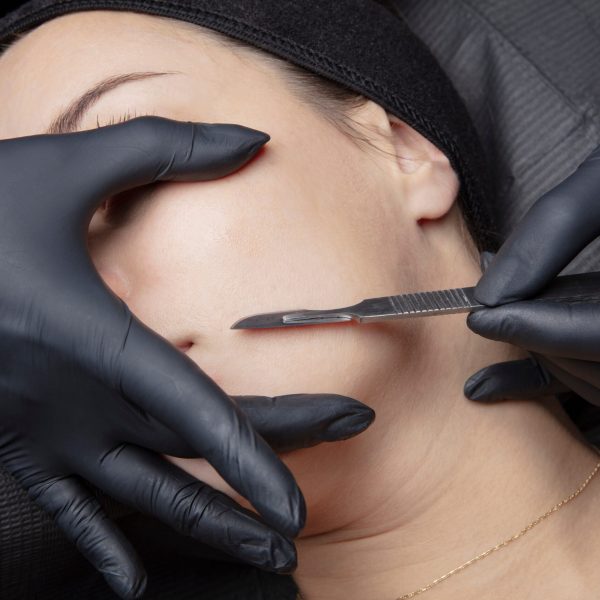 Dermaplaning aberdeen uk
